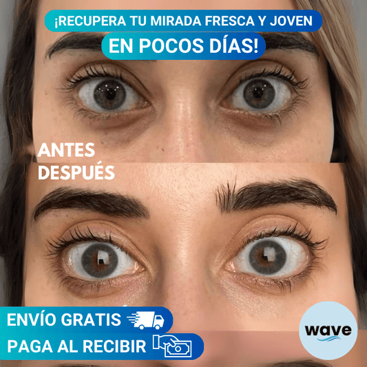 Veze™ Serum Roll-On: Retinol y Colágeno + Envío Gratis