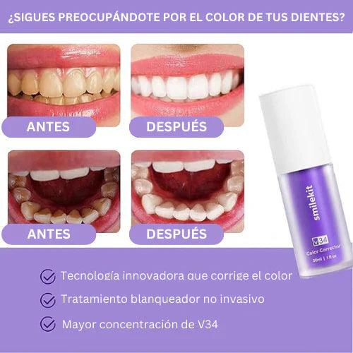 Blanqueador Dental V34™ - Envío Gratis y Pago Contra Entrega