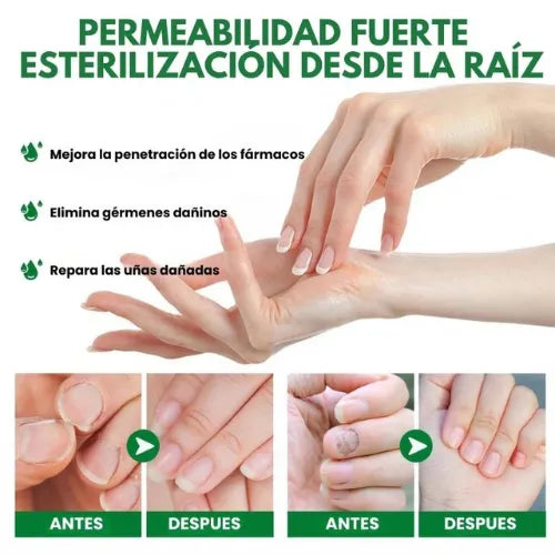 Compra 1 Lleva 3 – 7 Days Fungus Free® | Protege y Recupera Tus Uñas